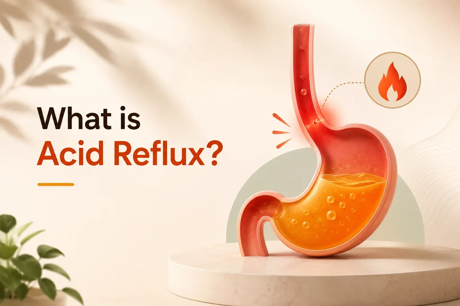 What is Acid Reflux